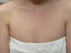 Chest Veins