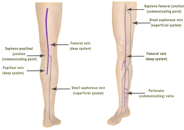 Leg Vein Anatomy By Vein Specialist In Los Angeles