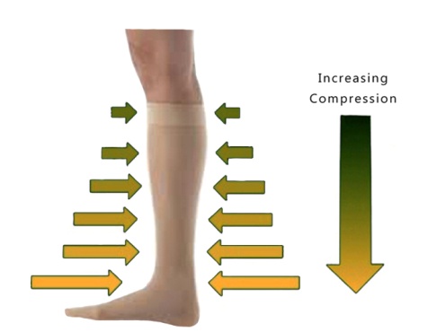 Pressure Variation in Gradual Compression Stockings